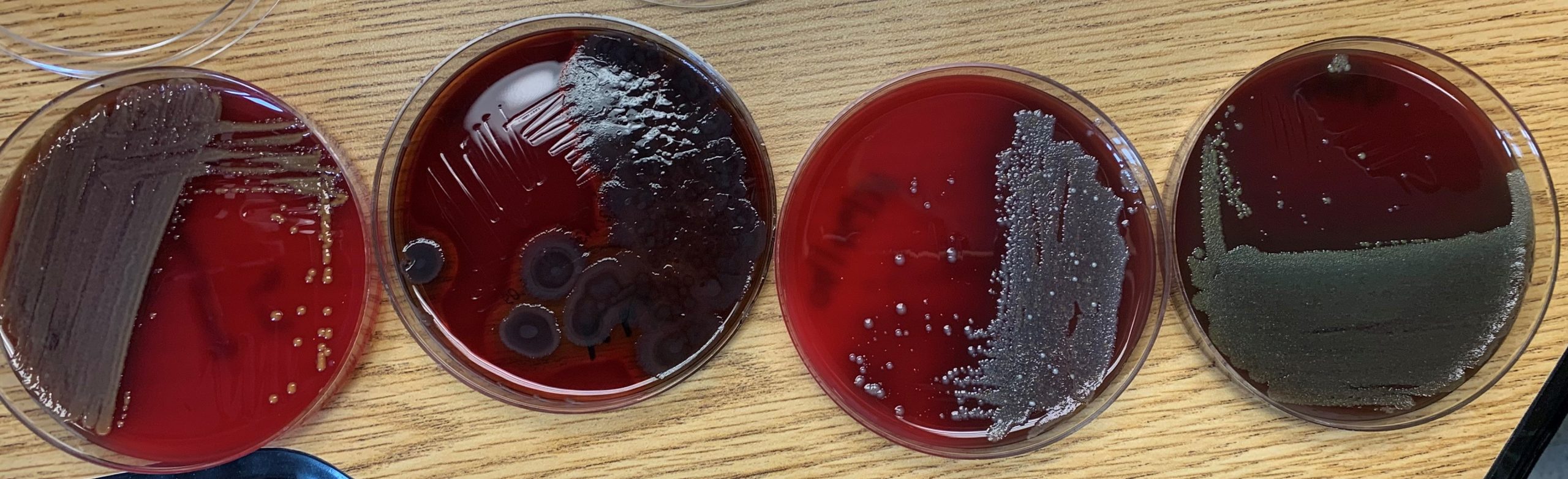 Blood Agar Plates Growing Culture